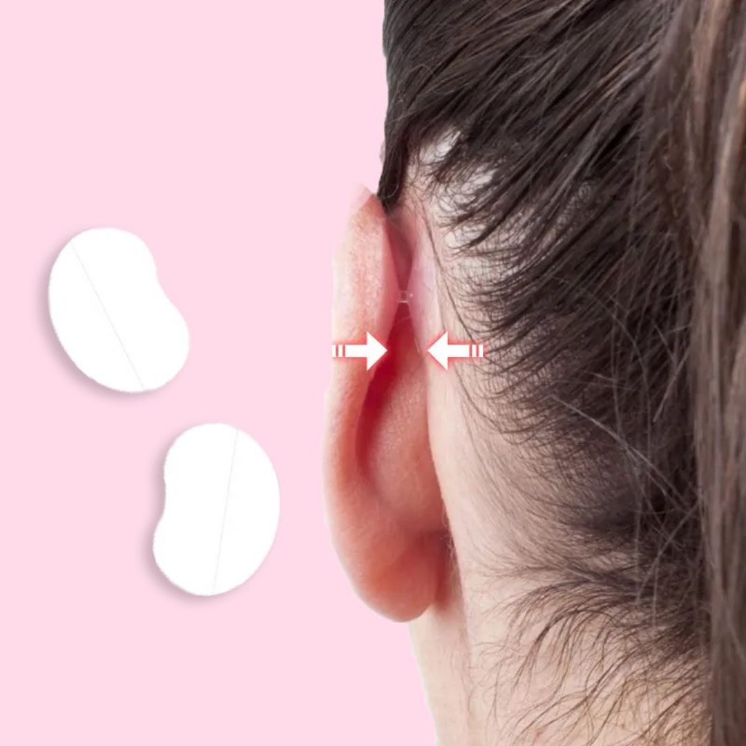 EarAlign™ - Comfortable ear molding patches